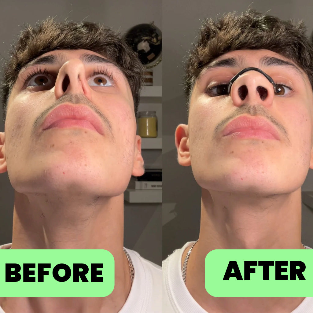 BreathAero™ Nose Strip